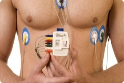 Holter EKG i Holter krvnog pritiska sa očitavanjem. Popust